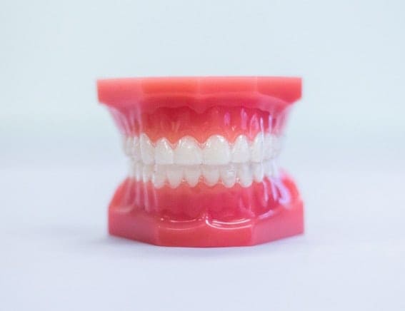 Clear Aligners model